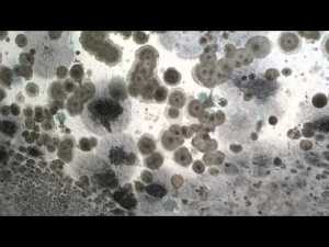 mycotoxin black mold