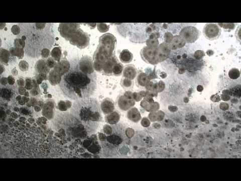 Black Mold Health Effects Black Mold Health Effects